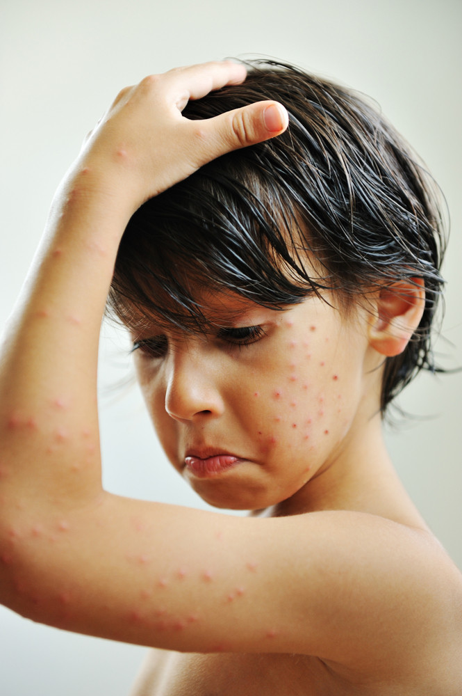 skin-illness-royalty-free-stock-image-storyblocks